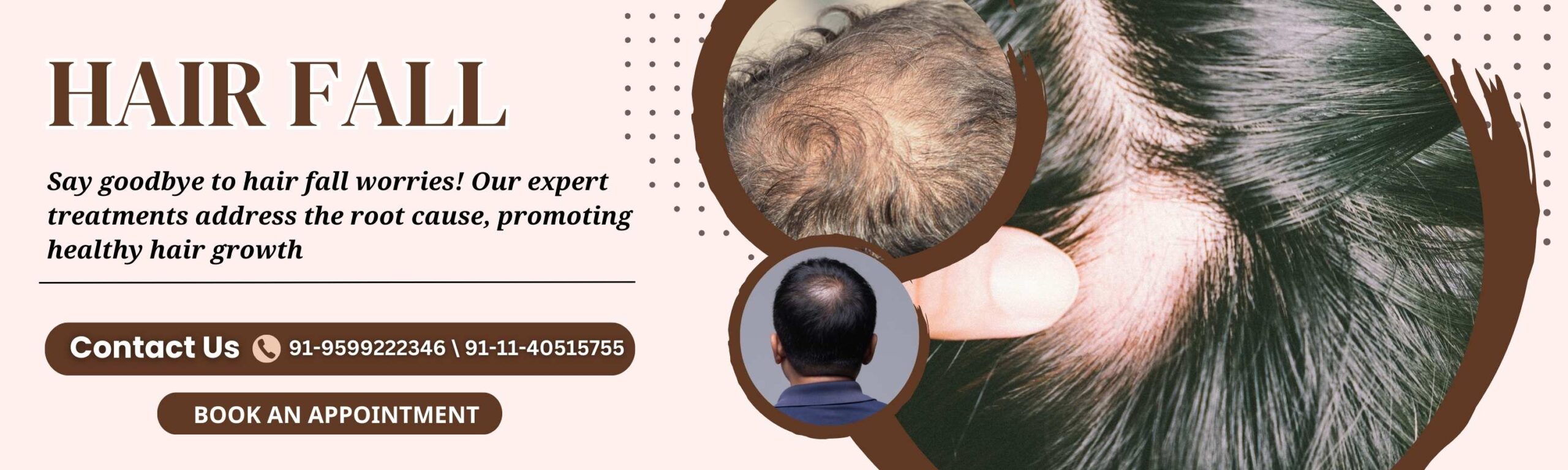 Hair growth 2025 doctor in delhi