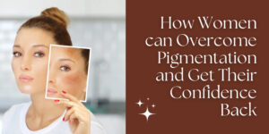 Best Pigmentation Treatment in Delhi