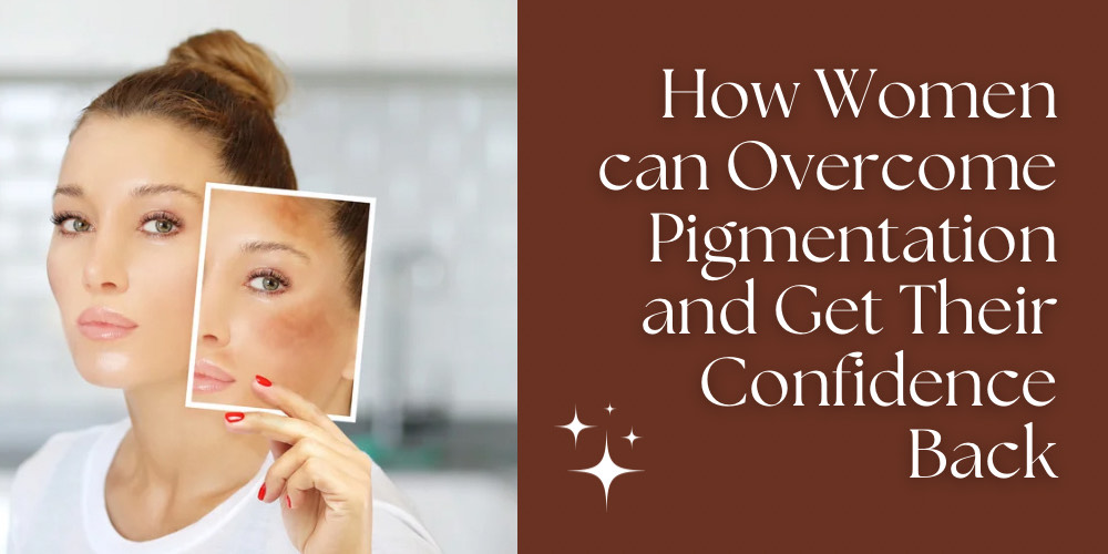 Best Pigmentation Treatment in Delhi