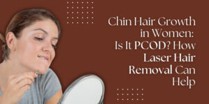 PCOD Causes and Laser Treatment