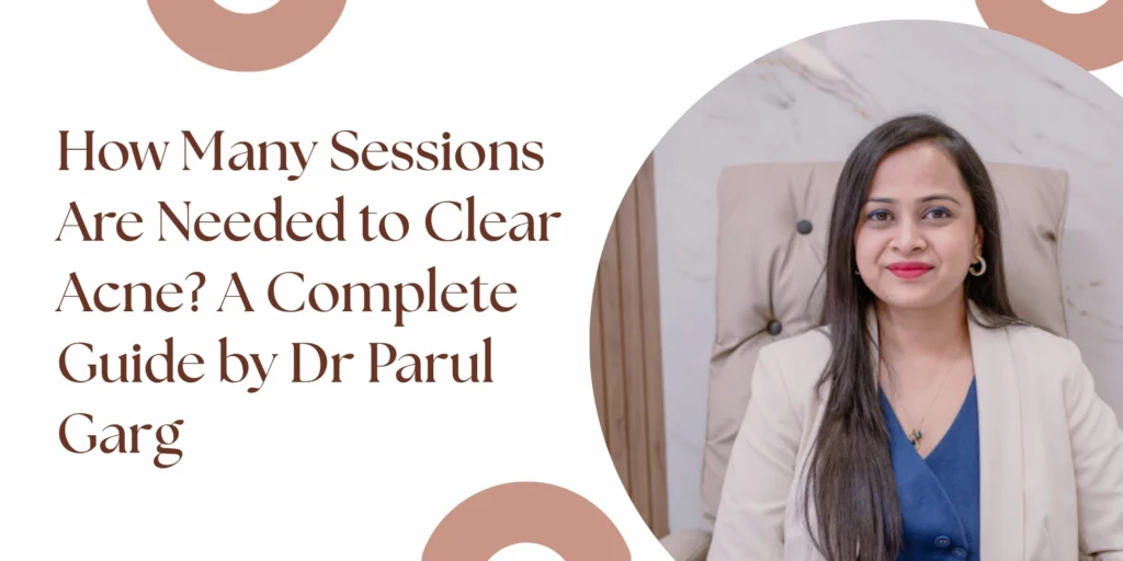 Acne treatment session results