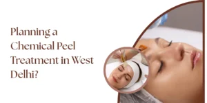 Chemical peel treatment guide