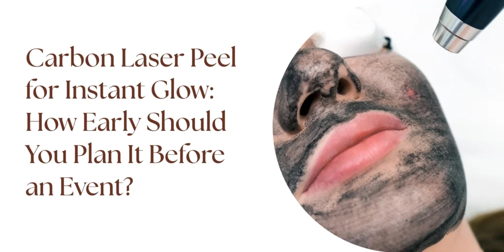 carbon laser peel instant glow