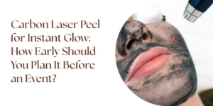 carbon laser peel instant glow