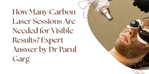 carbon laser treatment results on face