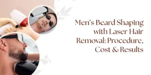mens-beard-laser-shaping