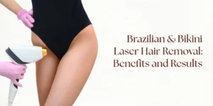 bikini laser hair removal treatment