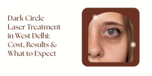 dark circle laser treatment in West Delhi results and cost