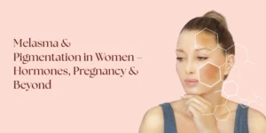 melasma treatment West Delhi