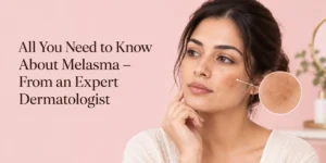Melasma Treatment in Delhi