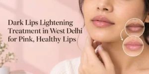 Dark lips treatment in Delhi